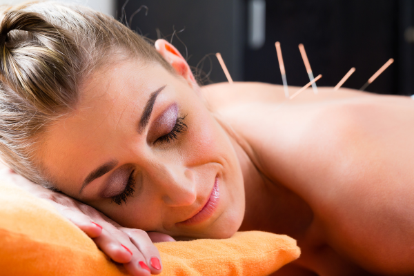 Acupuncture1