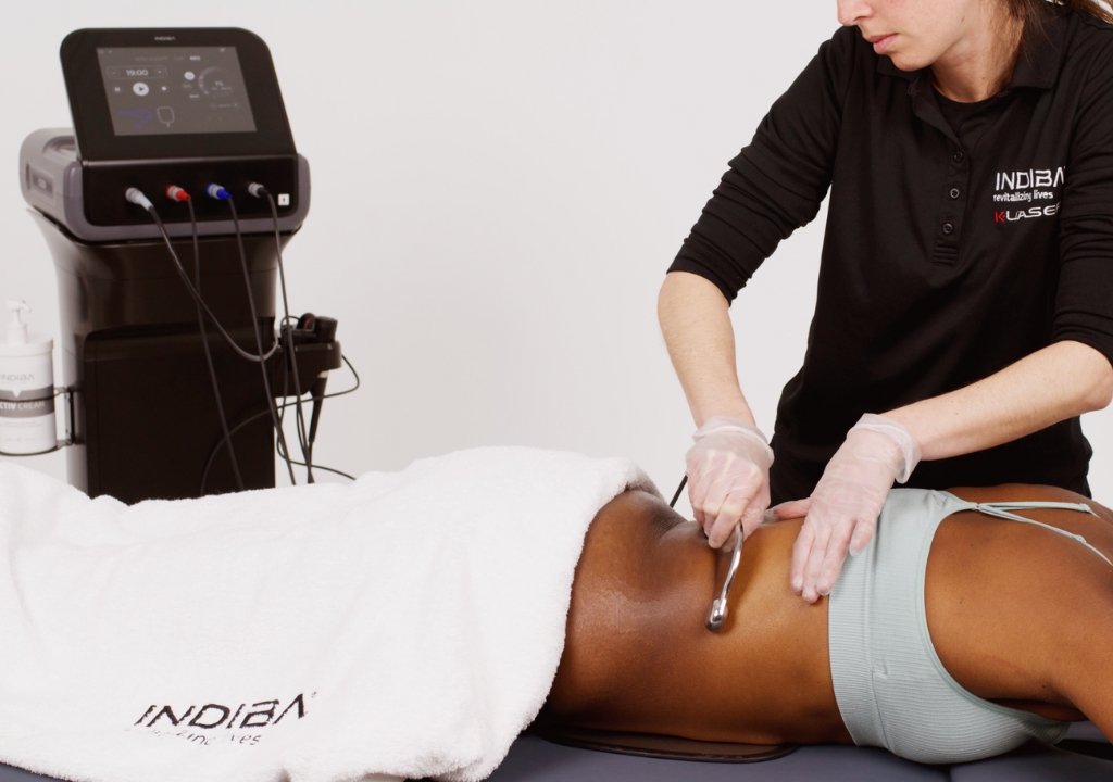 A person receives a body contouring treatment with a handheld device by a practitioner wearing gloves, next to a medical machine labeled INDIBA.